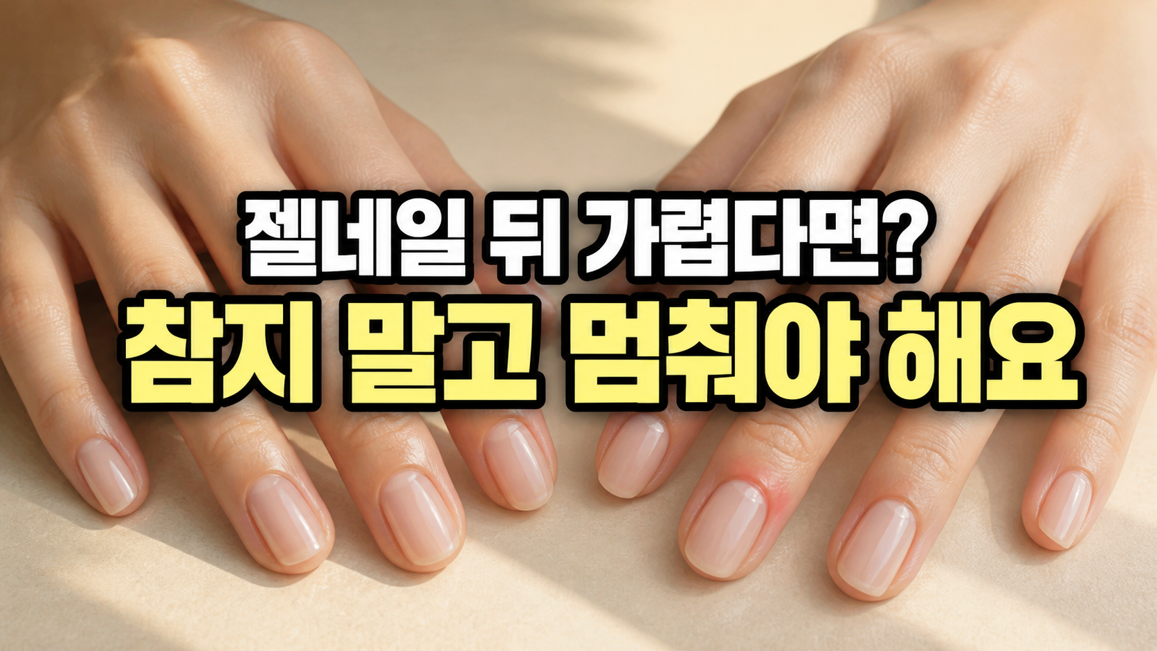 젤네일 후 가려움과 붉은 기가 생긴 손톱을 보여주는 주의 썸네일